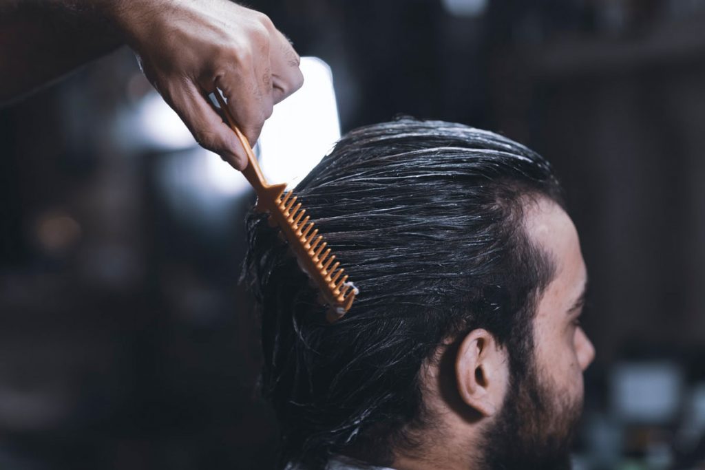 Haarausfall bei Männern – Haartransplantation als Lösung