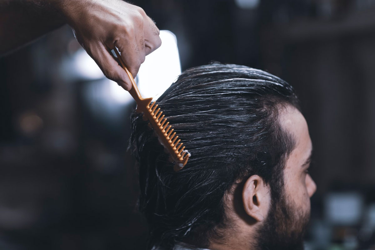 Titelbild zu „Haarausfall bei Männern – Haartransplantation als Lösung“