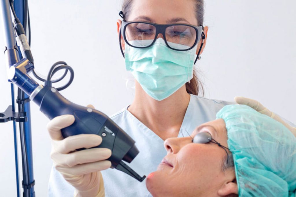Falten und Aknenarben mit dem Laser behandeln: Wie das Laserlifting wirkt